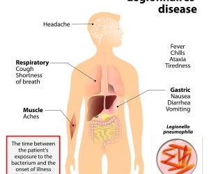 Hot Water Legionella & Your Hot Water Storage Tank